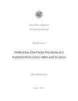 Primjena zračnog poliranja u parodontologiji i implantologiji