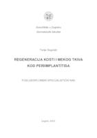 Regeneracija kosti i mekog tkiva kod periimplantitisa