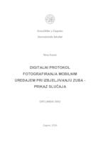 Digitalni protokol fotografiranja mobilnim uređajem pri izbjeljivanju zuba - prikaz slučaja