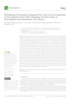 Mandibular Overdenture Supported by Two or Four Unsplinted or Two Splinted Ti-Zr Mini-Implants: In Vitro Study of Peri-Implant and Edentulous Area Strains