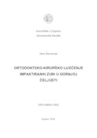 Ortodontsko-kirurško liječenje impaktiranih zubi u gornjoj čeljusti