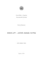 Sinus lift - jučer, danas, sutra