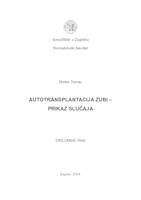 Autotransplantacija zubi - prikaz slučaja