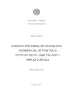 Digitalni protokol intraoralnog skeniranja i 3D printanja potpuno ozubljene čeljusti - prikaz slučaja