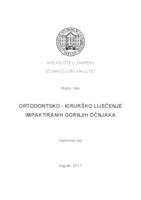 Ortodontsko-kirurško liječenje impaktiranih gornjih očnjaka