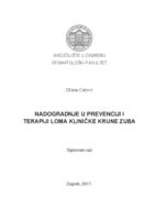 Nadogradnje u prevenciji i terapiji loma kliničke krune zuba