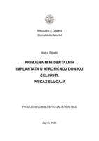 Primjena mini dentalnih implantata u atrofičnoj donjoj čeljusti