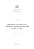 Primjena dermatoskopije u dijagnostici pigmentnih lezija na oralnoj sluznici