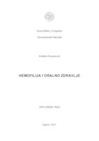 Hemofilija i oralno zdravlje