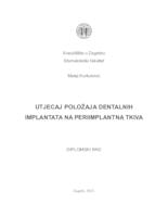 prikaz prve stranice dokumenta Utjecaj položaja dentalnih implantata na periimplantna tkiva