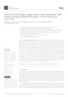 prikaz prve stranice dokumenta Lateral Alveolar Ridge Augmentation with Autogenous Tooth Roots and Staged Implant Placement—5-Year Follow-Up Case Series