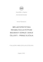 prikaz prve stranice dokumenta Implantoprotetska rehabilitacija potpune bezubosti gornje i donje čeljusti - prikaz slučaja